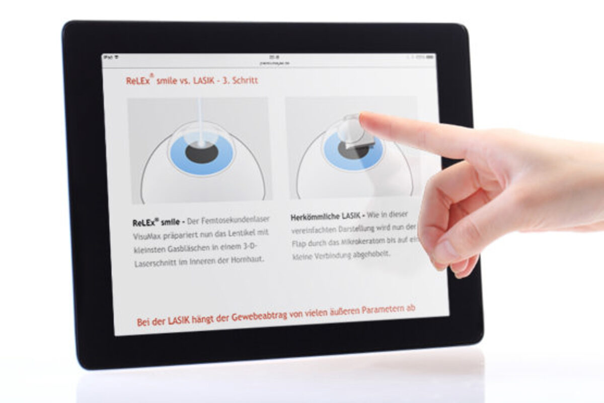 Augenlasern SMILE pro