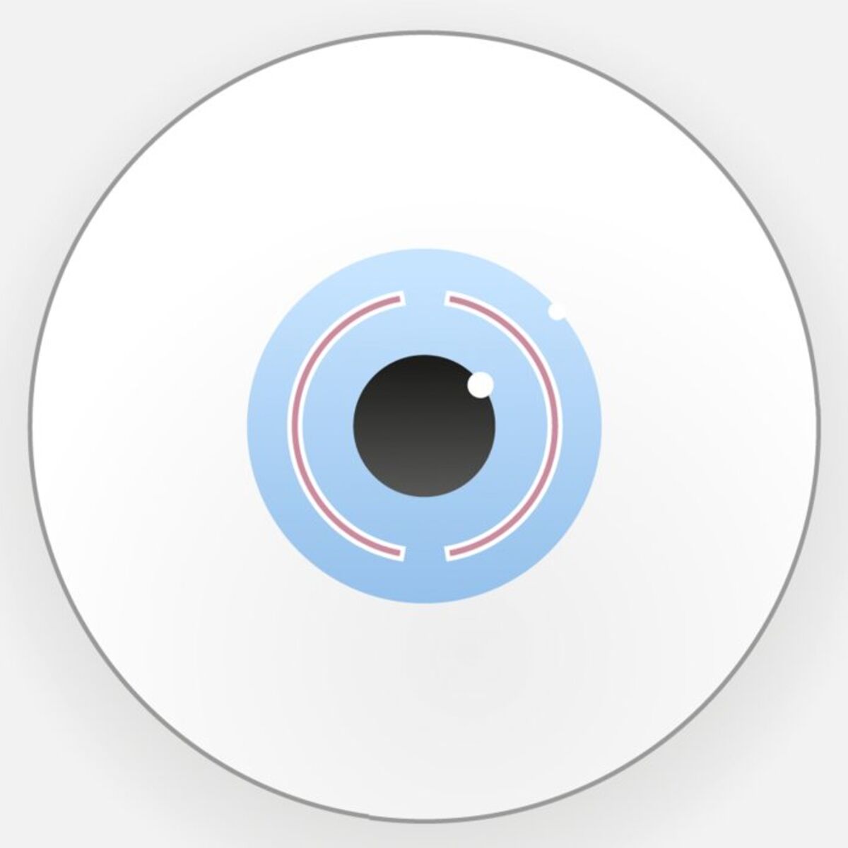 Intrastromale Ringsegmente All-Femto-CAIRS