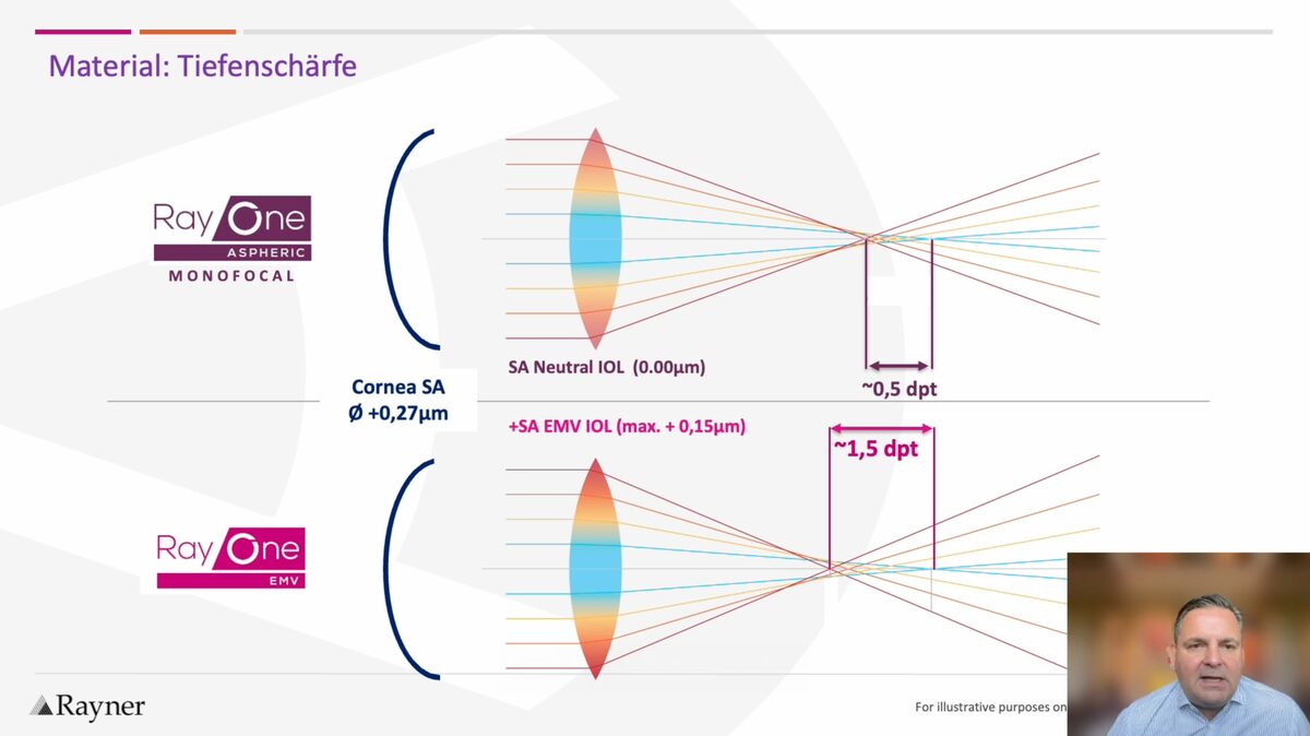 Darstellung der Tiefenschärfe der RayOne Monofokal und EMV