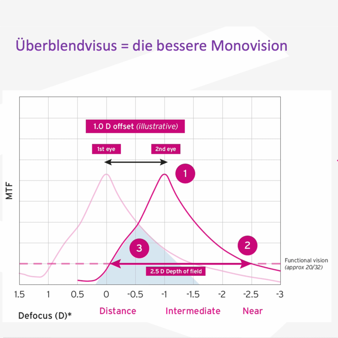 Erste Sehergebnisse mit der RayOne EMV im Überblendvisus