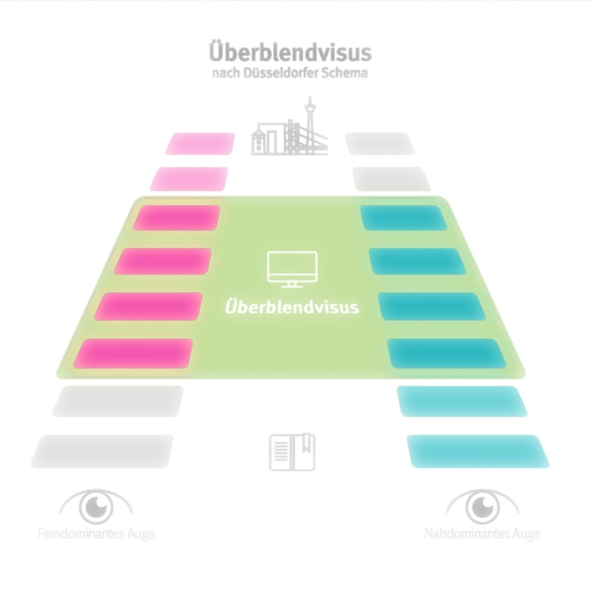 PresbyEDoF – eine neue Strategie zur Korrektur der Alterssichtigkeit mit einem Excimerlaser