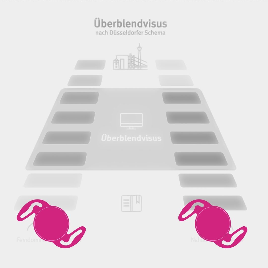 True blended vision: Das Düsseldorfer Schema mit einer IOL mit positiver sphärischer Aberration