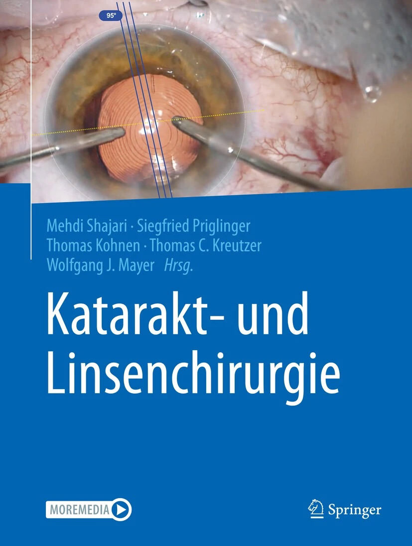 Cover des Springer-Lehrbuches zur Katarakt- und Linsenchirurgie
